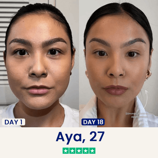 The Medilysa™ Lift : Say goodbye to your double chin now