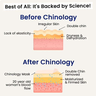 The Medilysa™ Lift : Say goodbye to your double chin now