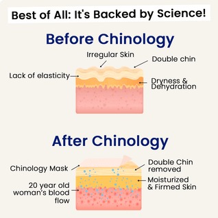 The Medilysa™ Lift : Say goodbye to your double chin now