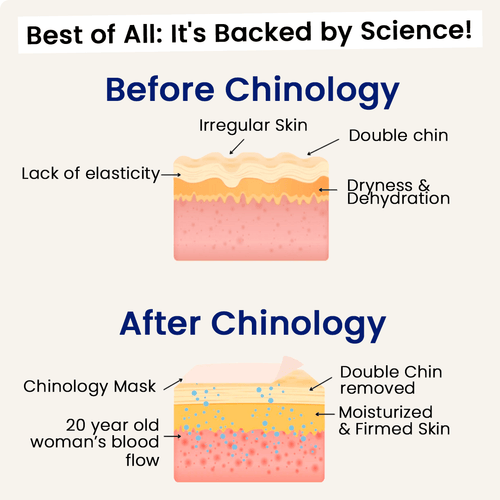 The Medilysa™ Lift : Say goodbye to your double chin now