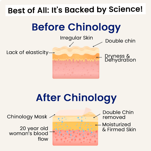 The Medilysa™ Lift : Say goodbye to your double chin now